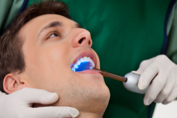 White Fillings Laser